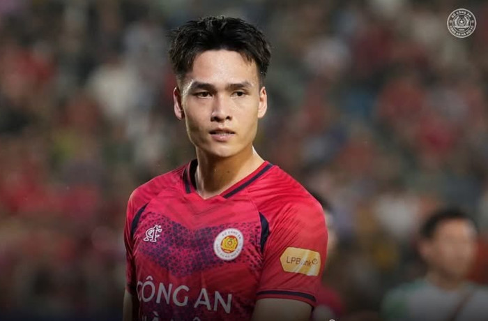 Bùi Hoàng Việt Anh khả năng cao vắng mặt ở ĐT Việt Nam vì chấn thương